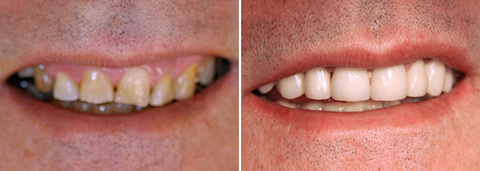Charlestown Dental Care - Cairns Dentist 4