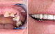 Charlestown Dental Care - thumb 5