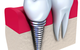 Honeysuckle Dental - thumb 7