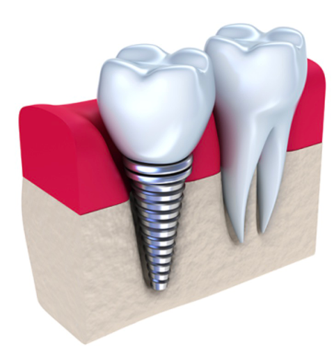 Honeysuckle Dental - Cairns Dentist 7