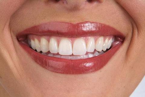 It's Your Smile - Cairns Dentist 1