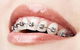 Dental Centre Buderim - thumb 9