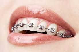Dental Centre Buderim - Cairns Dentist 9