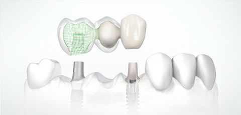 Park Terrace Dental - Dr Damian Chung - Port Lincoln - Cairns Dentist 7
