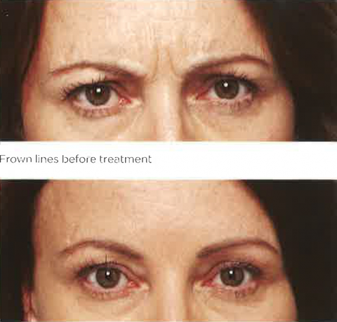 Bay Cosmetic Centre - Cairns Dentist 2