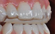 Hermitage Dental - thumb 4