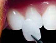 Hermitage Dental - Cairns Dentist 6
