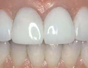 Hermitage Dental - Cairns Dentist 7