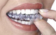 Hermitage Dental - thumb 8