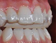Hermitage Dental - Cairns Dentist 9