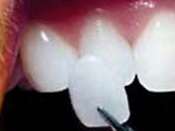 Hermitage Dental - Cairns Dentist 16
