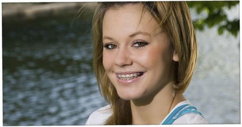Smiling Wide Orthodontics - Cairns Dentist 0
