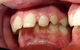 Smiling Wide Orthodontics - thumb 2