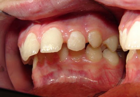 Smiling Wide Orthodontics - Cairns Dentist 2