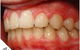Smiling Wide Orthodontics - thumb 3