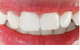 Aura Dental Centre - thumb 5