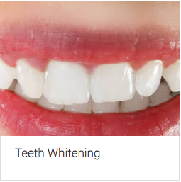 Aura Dental Centre - Cairns Dentist 5