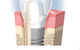 Aura Dental Centre - thumb 6