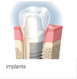 Aura Dental Centre - Cairns Dentist 6