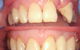 Fraser Shores Family Dental - thumb 3
