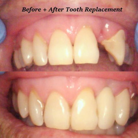 Fraser Shores Family Dental - Cairns Dentist 3