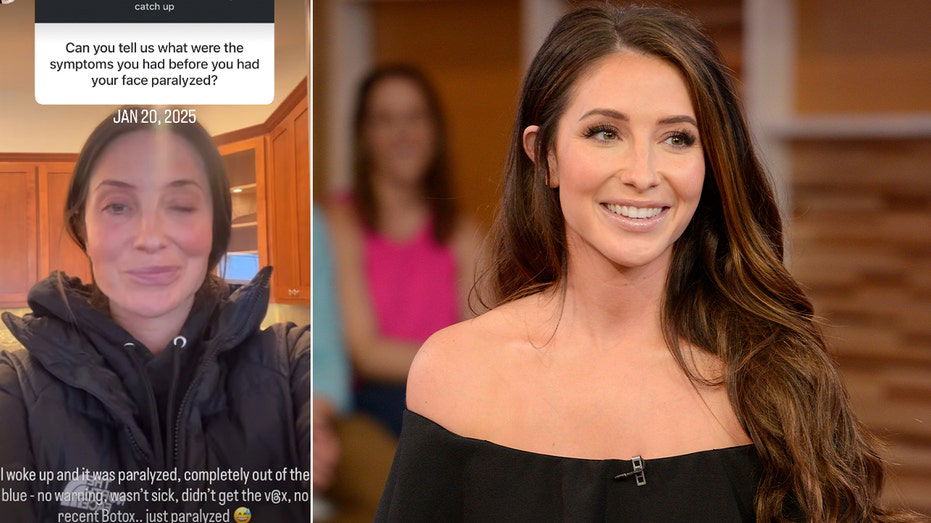 Bristol Palin says her facial paralysis struck 'completely out of the blue' with no warning signs