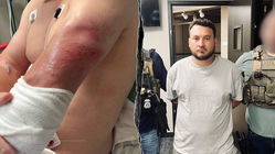 ICE agent dragged for nearly a block by Honduran migrant attempting to escape federal custody: authorities