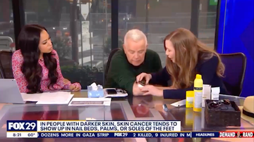 TV host discovers he has skin cancer during live on-air broadcast